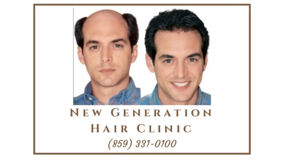 hair replacement systems, wigs, custom hair replacement, men woman and children, hair clinic, free consultations