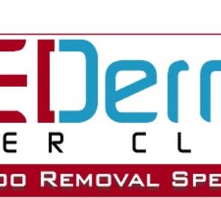 medermis tattoo removal austin tx